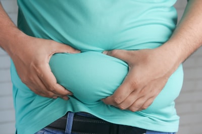 obésité — Obesity