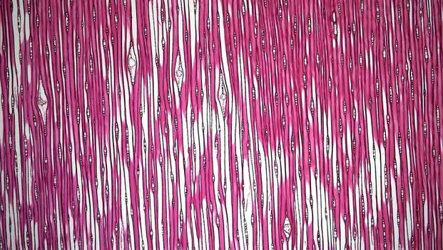 Волокнистые мембраны — Fibrous membranes