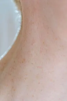 nape — потилиця