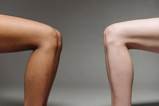 knee — koleno