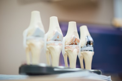 prothèse de l'articulation de la hanche — Joint hip replacement