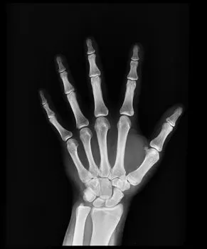 сустав — joint