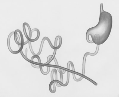 hernie — Hernia