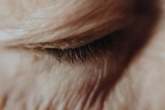 Веко — Eyelid