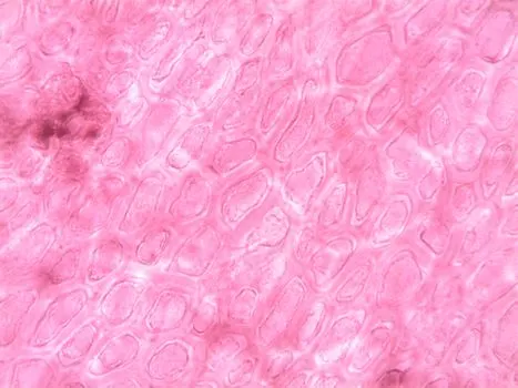 Гранулемы тела — Body granulomas