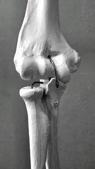 Связки — Ligaments
