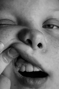 Morder — Bite