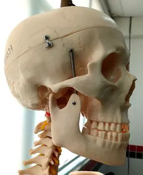 скуловая дуга — Zygomatic arch