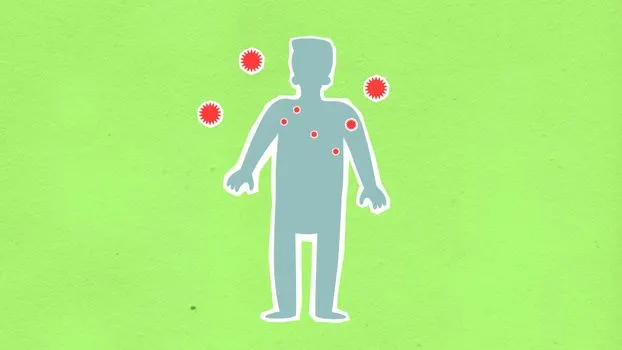 Корь — Measles
