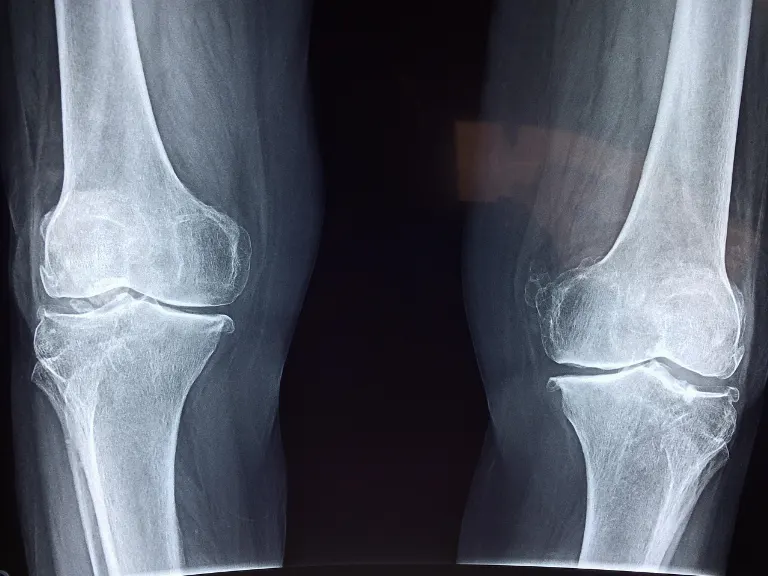 orthopedic — orthopédique